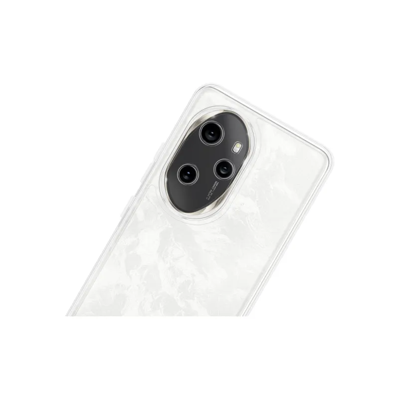 YADIQI Phone Cases-2