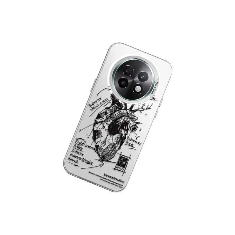MANQIN Phone Cases-11