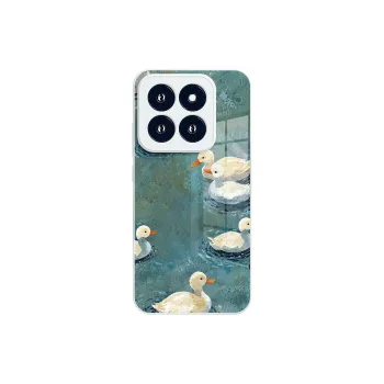 Small bones Phone Cases