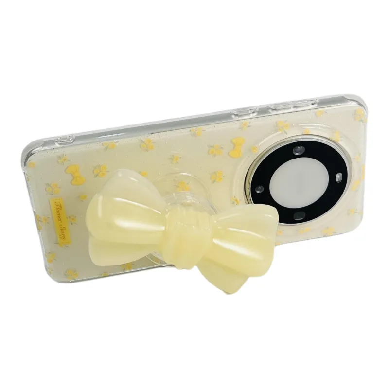 Wei Xin Acrylic Material Electroplated Spotted Dog Phone Cases Compatibility  Huawei Mate 70/60/50 Pro/Pura 70/70 Pro+-3