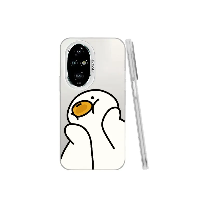 Baochengbao Phone Cases-15