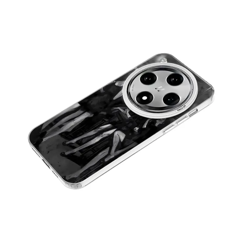 Baochengbao Phone Cases-22