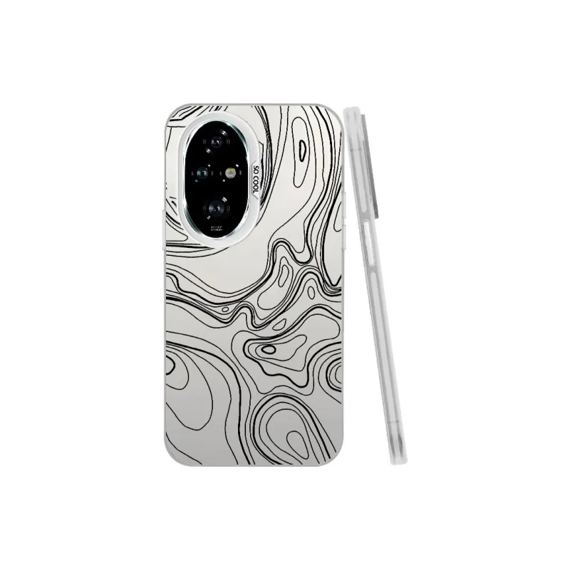 YIBAOBAO Phone Cases-3