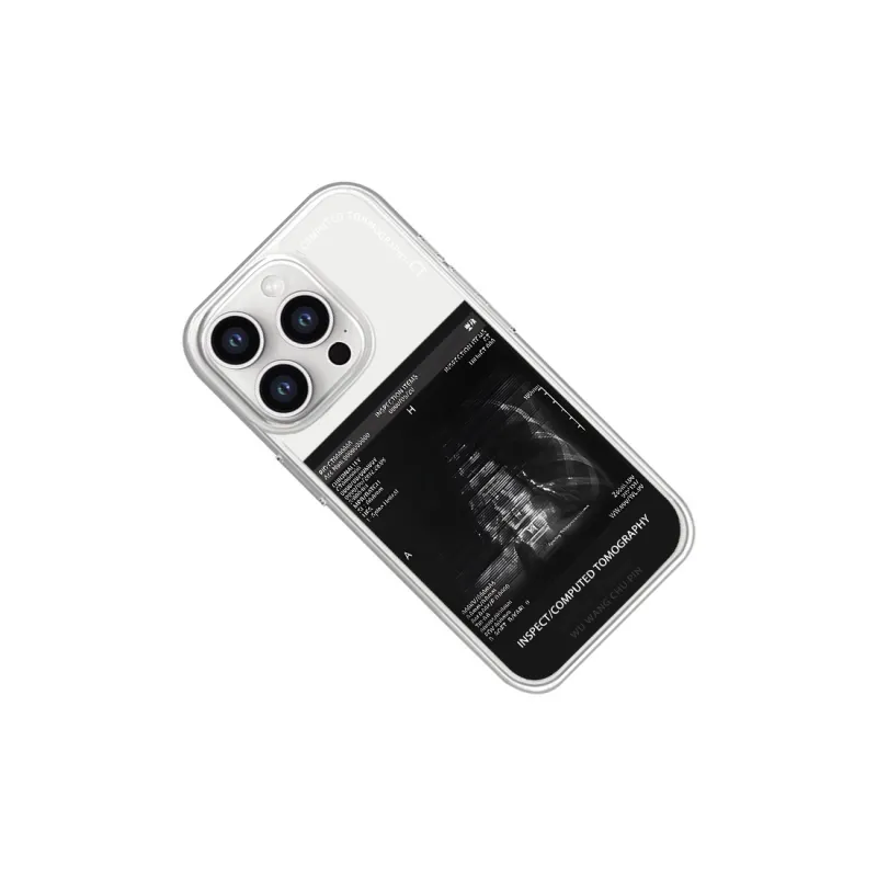 SCUD Phone Cases-10