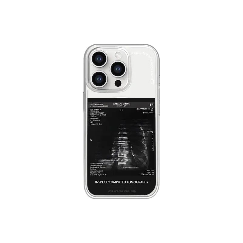 SCUD Phone Cases-6