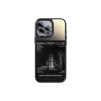 SCUD Phone Cases