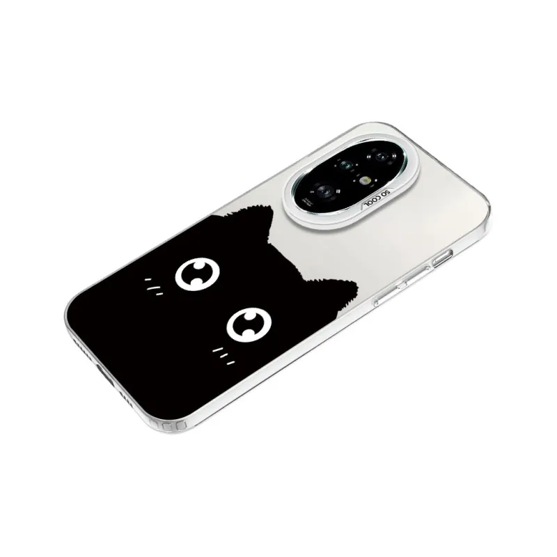 YIBAOBAO Phone Cases-19