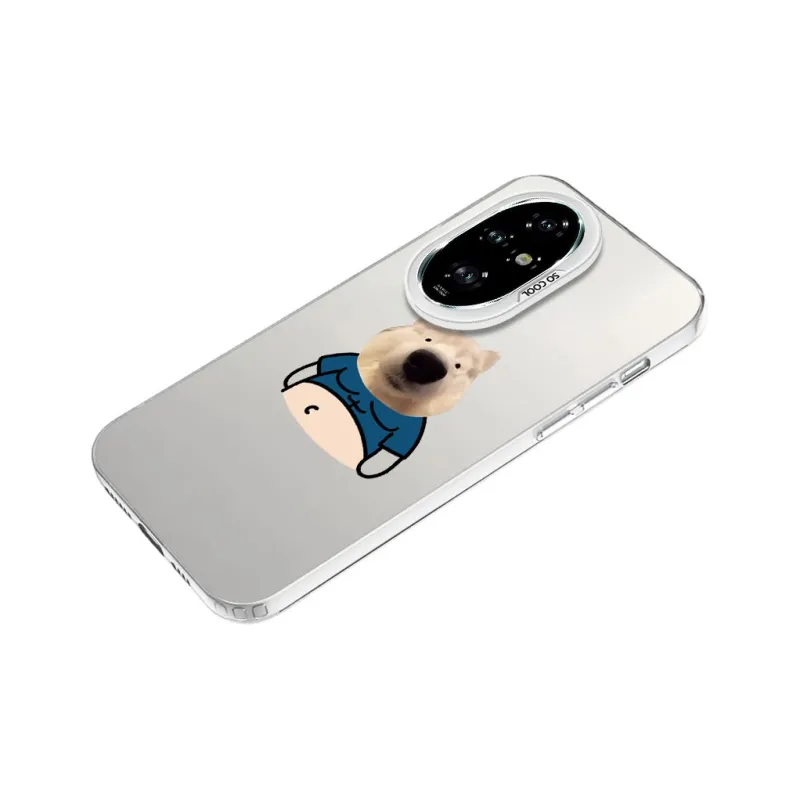 YIBAOBAO Phone Cases-16