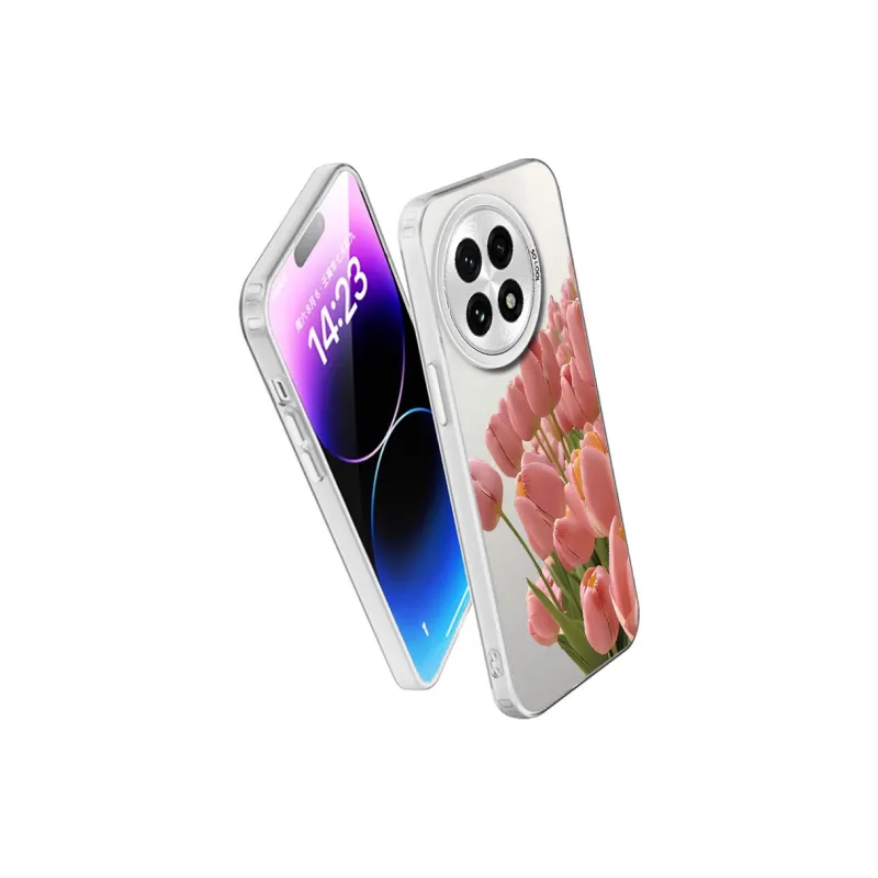 MaiBuZhe Phone Cases-14